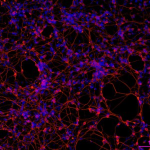 Closeup of a part of a network of neuron cells